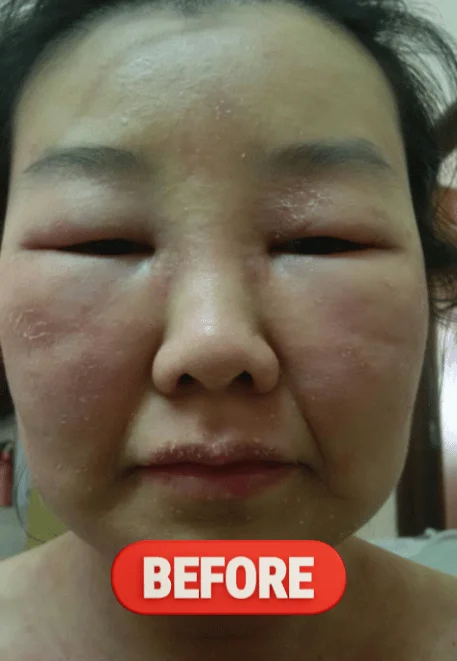 Before
